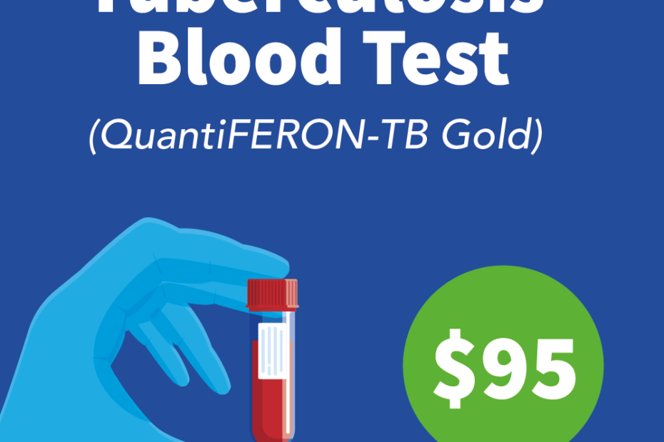 The QuantiFERON-TB Gold test is required for immigrants and refugees in the United States.