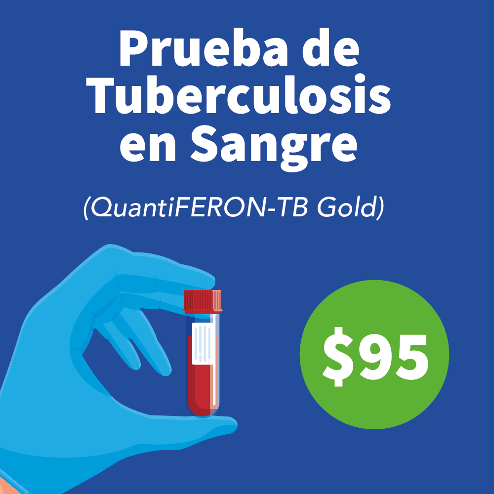 Prueba QuantiFERON-TB Gold es requerida a immigrantes y refugiados en los Estados Unidos.